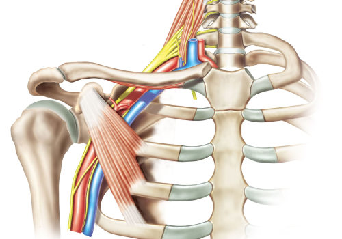 Understanding Brachial Plexus Injuries: Causes, Symptoms, and Recovery