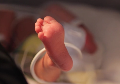 The Prevalence of Birth Injuries: An Expert's Perspective